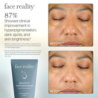 GlowTone™ Corrective Serum